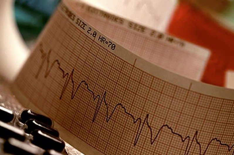 Fibrilacioni atrial po bëhet më i zakonshëm tek njerëzit e moshës së mesme
