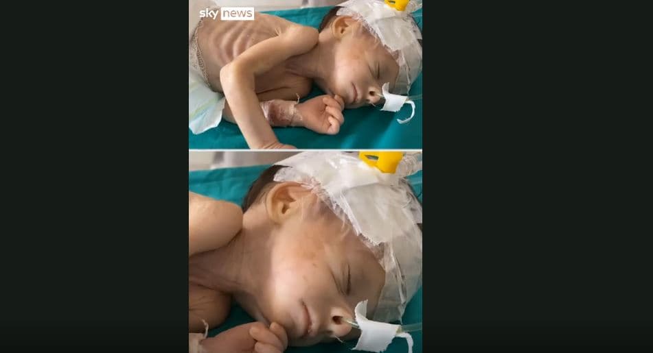 Foshnjat e porsalindura tani kanë pak shanse për të mbijetuar në Gaza