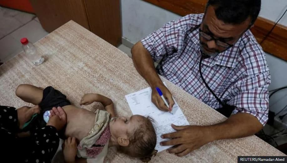 Paralizohet foshnja në Gaza, u infektua me poliomielit – rasti i parë në 25 vjet