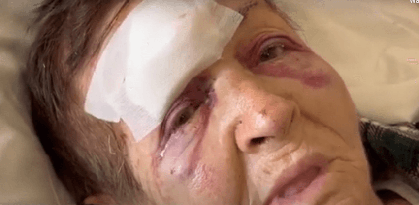 Nusja rrah rëndë vjehrrën në Shkodër (VIDEO)