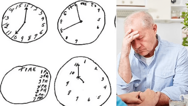 Një vizatim i thjeshtë mund të ndihmojë në diagnostikimin e demencës!