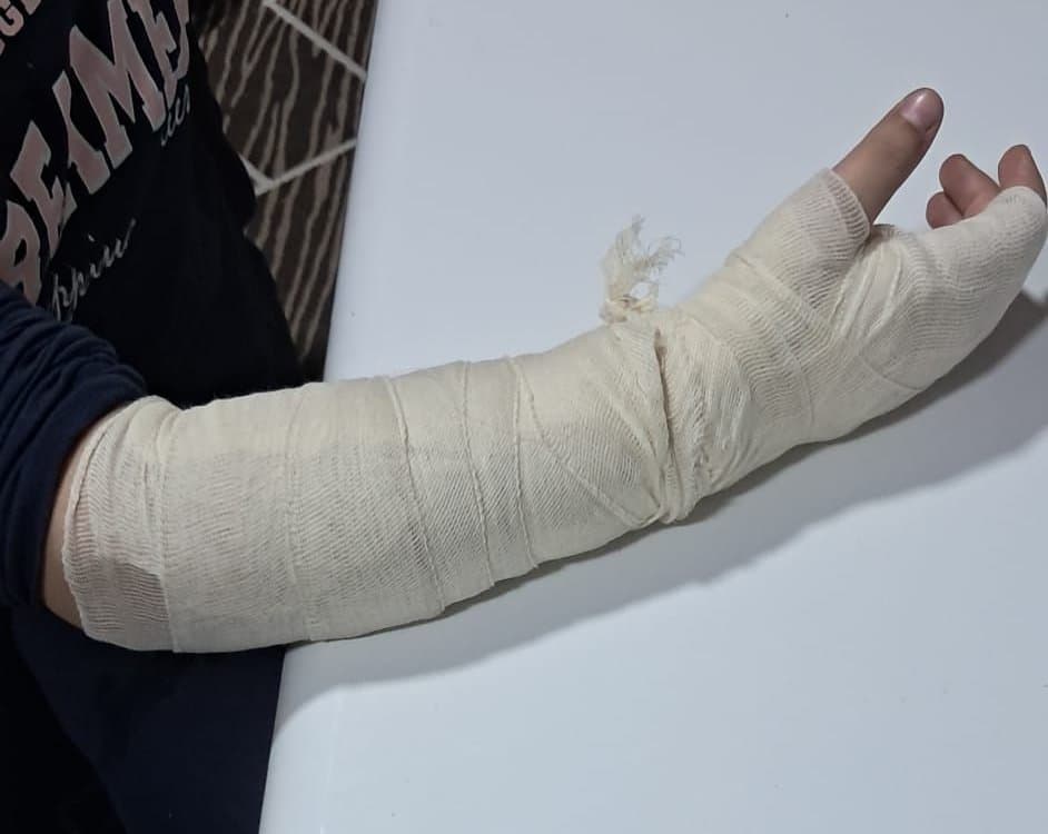 Skandal në Shkup: Mësuesja raportohet të ketë rrahur 10-vjeçaren nga Çairi, vajza përfundon në spital