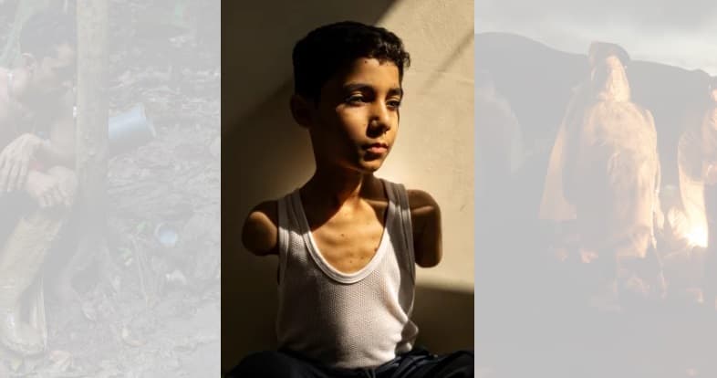 Portreti i një djali palestinez të plagosur shpallet fotoja më e mirë e “World Press Photo”