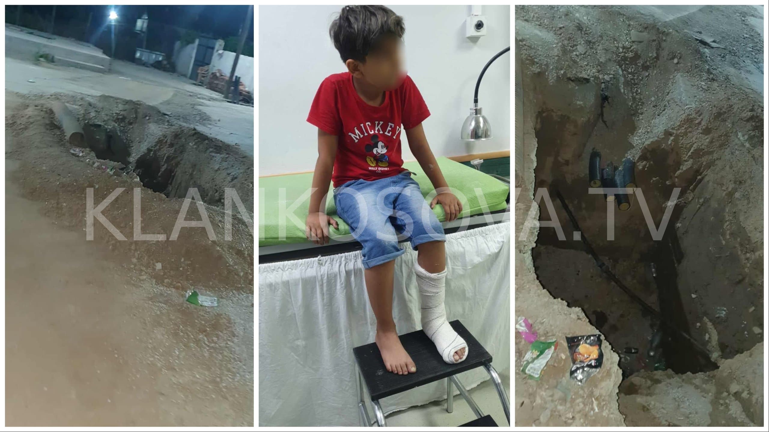 Ankohet babai në Gjakovë: Fëmija pësoi lëndime pasi ra në gropat e hapura për rrymë