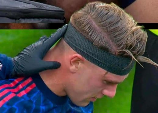 Viktor Gyokeres pëson lëndim në kokë në sfidën ndaj Athletic Bilbaos
