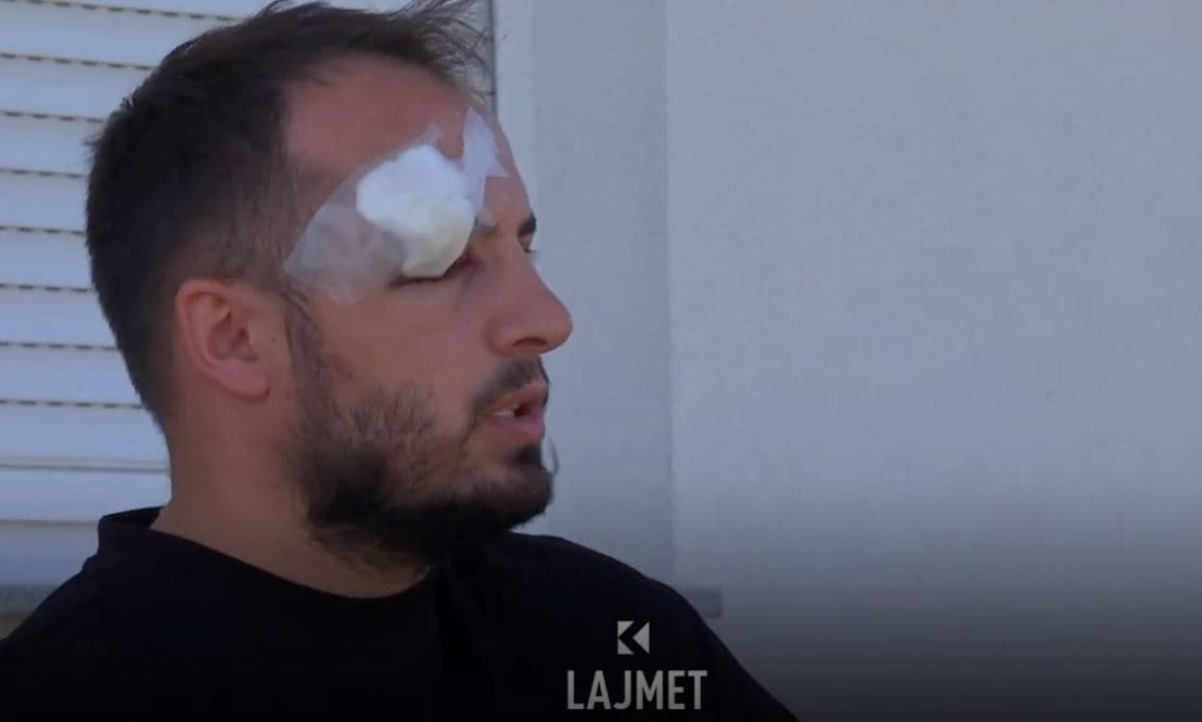 Incidenti në Pogragjë, varrosi babanë, gati u vra nga plumbi qorr (VIDEO)