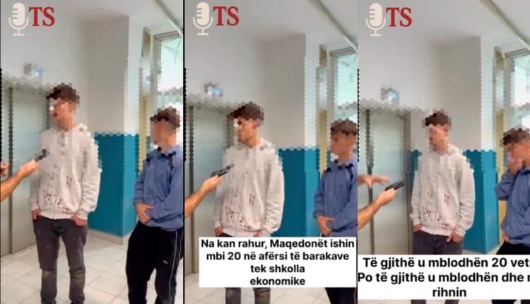 Mbi 20 tifozë të ''Vojvoda'' rrahën barabarisht dy nxënës shqiptarë në Tetovë (VIDEO)