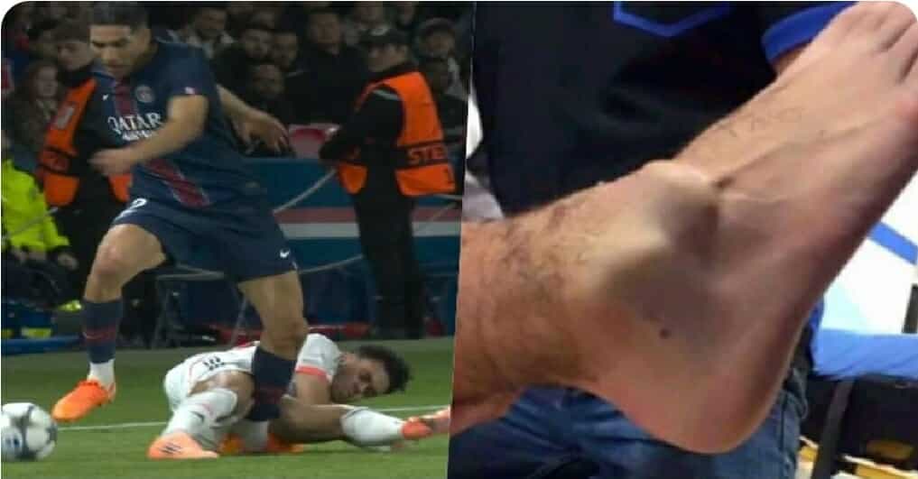 Upamecano i Bayernit kërkon të minimizojë “polemikat” pas lëndimit të Hakimit