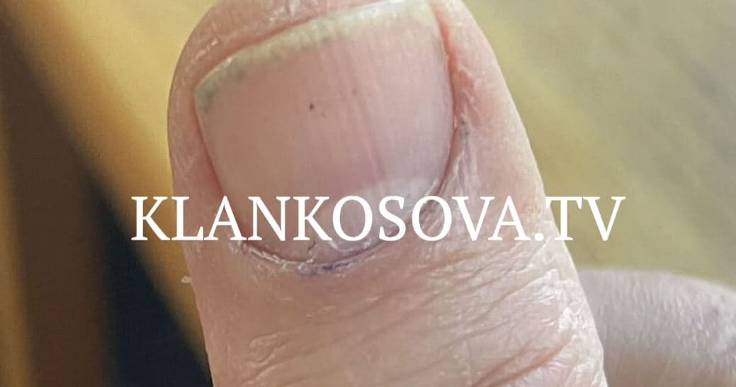 Ankohet qytetari: Ngjyra në gishtin tim u fshi 20 minuta pas votimit në “Meto Bajraktari”