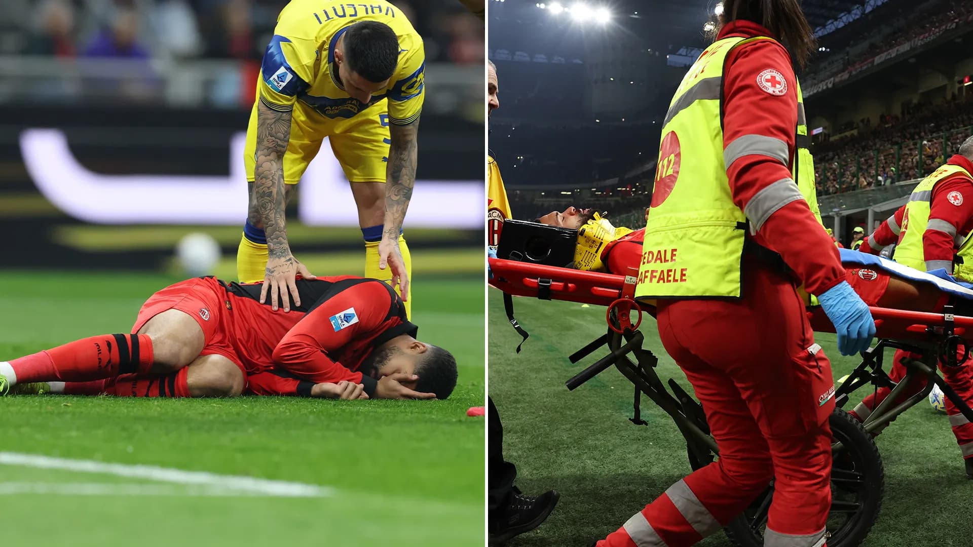 Dhëmbë të thyer dhe frakturë, lëndimi "horror" i Loftus-Cheek