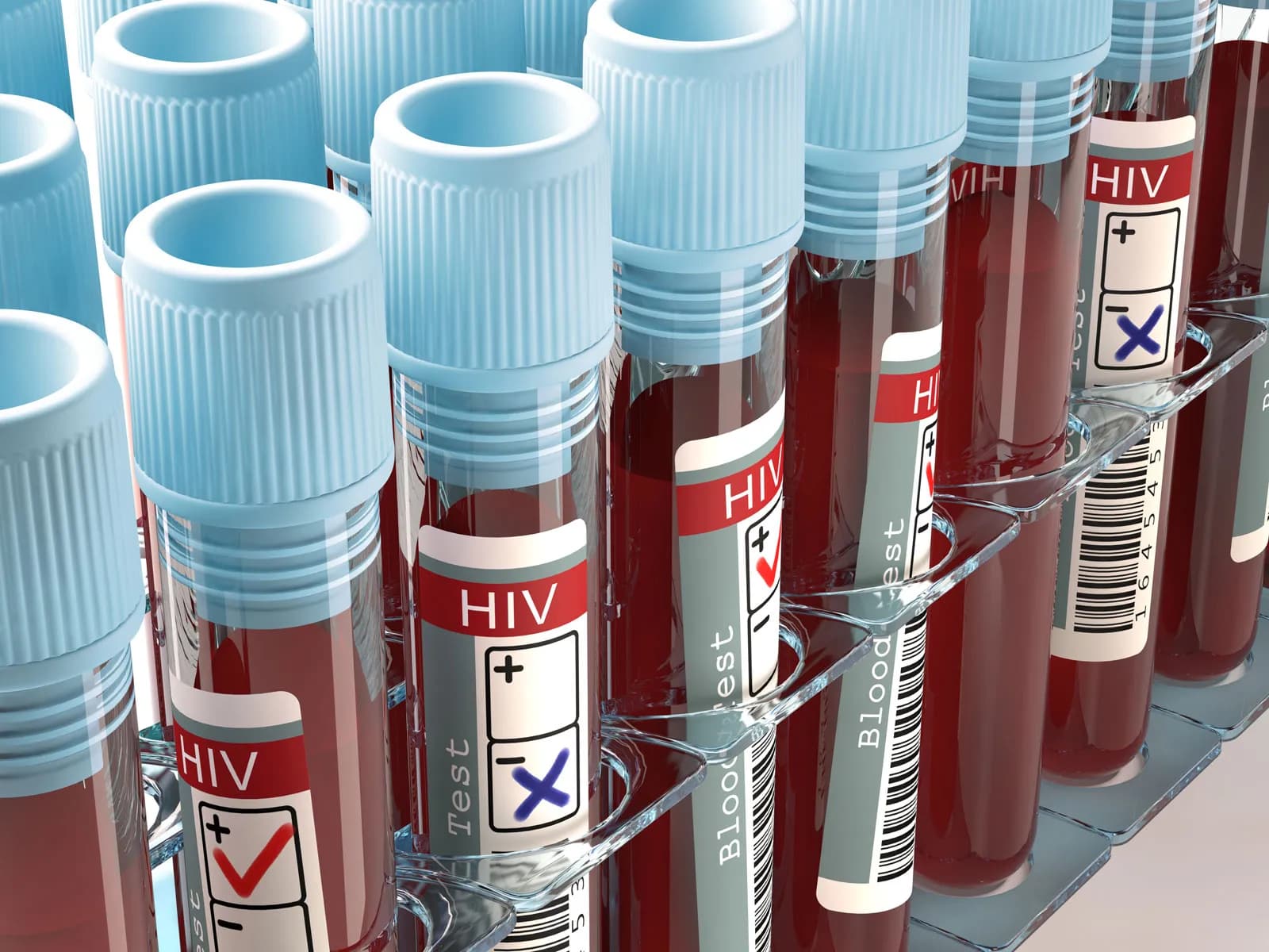 Rritje shqetësuese e rasteve me HIV në Shqipëri