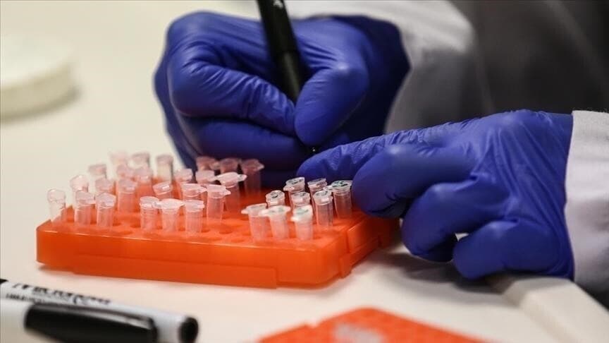 Gripi i shpendëve, dyshohet për një rast të ri në Australinë Perëndimore