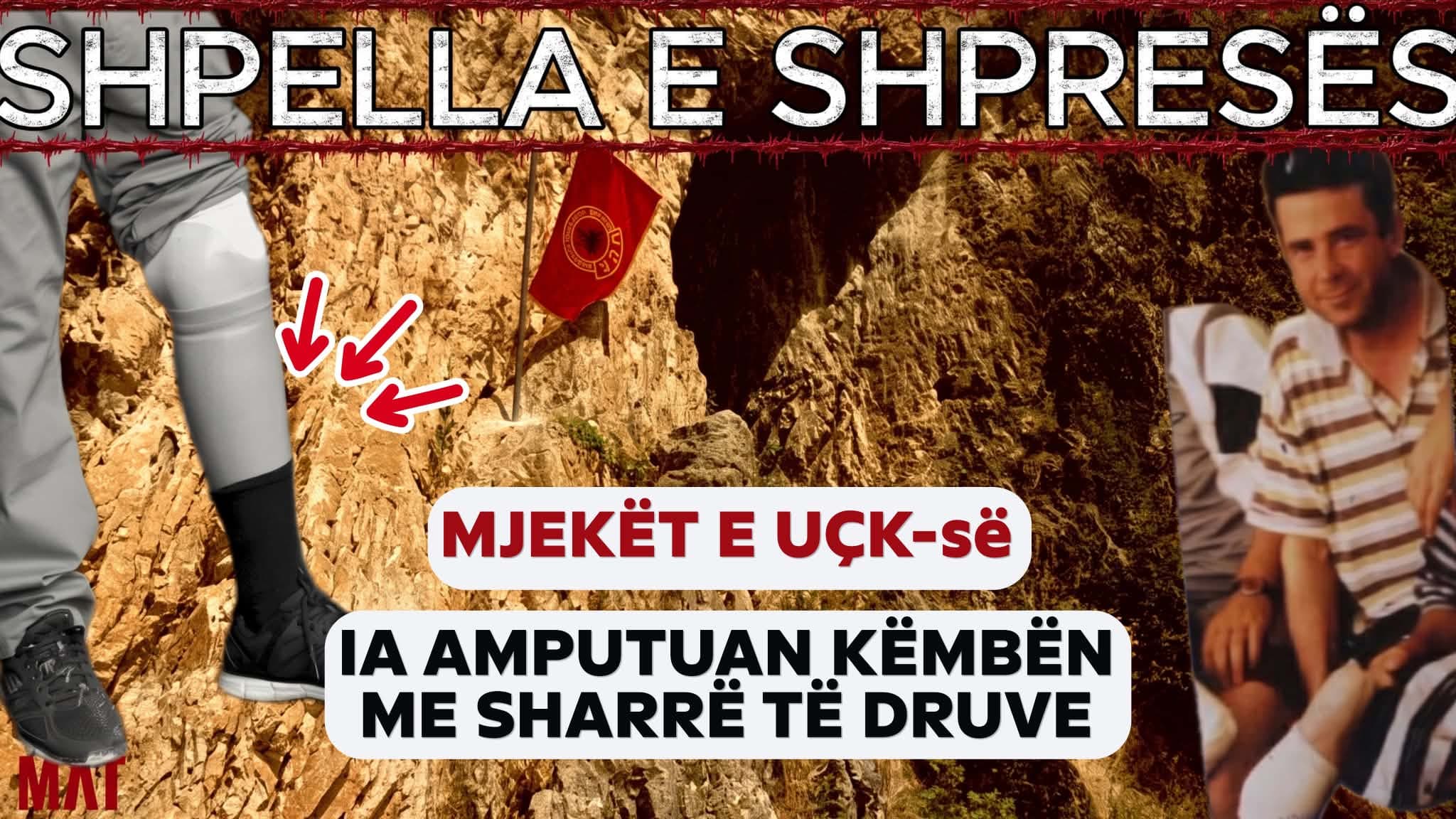 MAT - "Shpella e Shpresës": Si iu amputua me sharrë druri këmba ushtarit të plagosur të UÇK-së? (VIDEO)