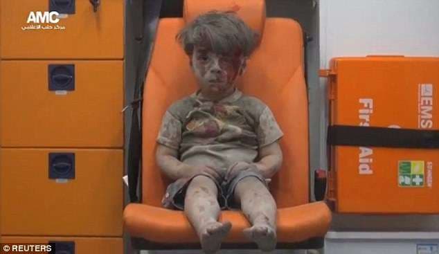Kështu duket sot djali sirian - imazhi i të cilit përloti botën (VIDEO)