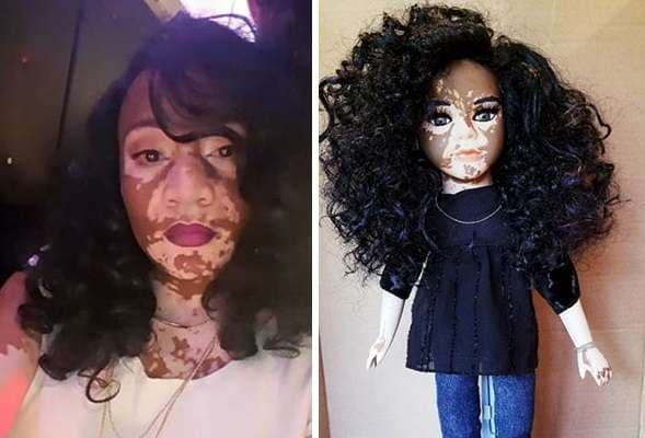 Artistja që krijon kukulla me “Vitiligo” (FOTO)