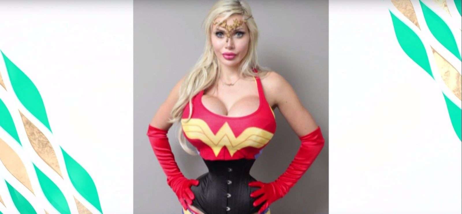 I heq gjashtë brinjë për t’u dukur si Wonder Woman (VIDEO)