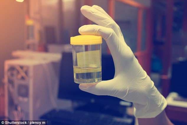 Një test i thjeshtë i urinës, ndihmon në diagnostifikimin e kancerit