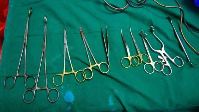 Gruaja japoneze padit qeverinë për sterilizim të detyruar