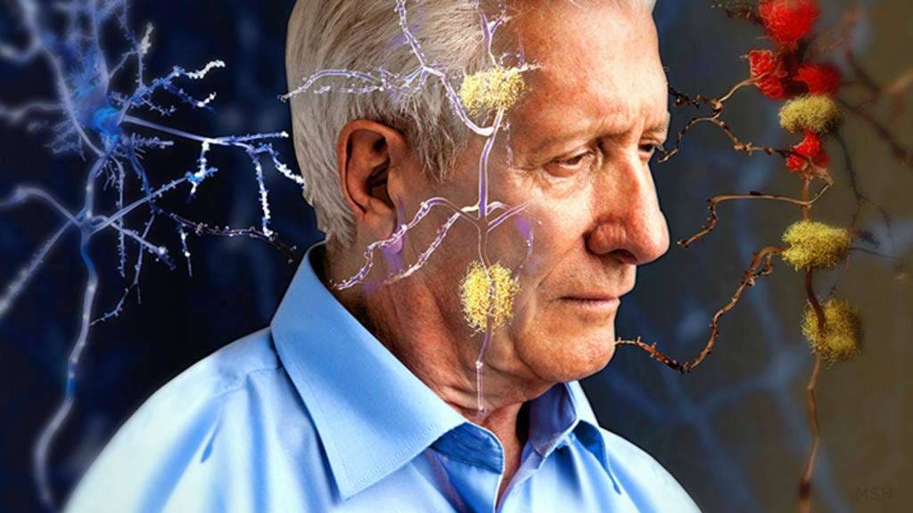 Alzheimeri mund të ketë shërim