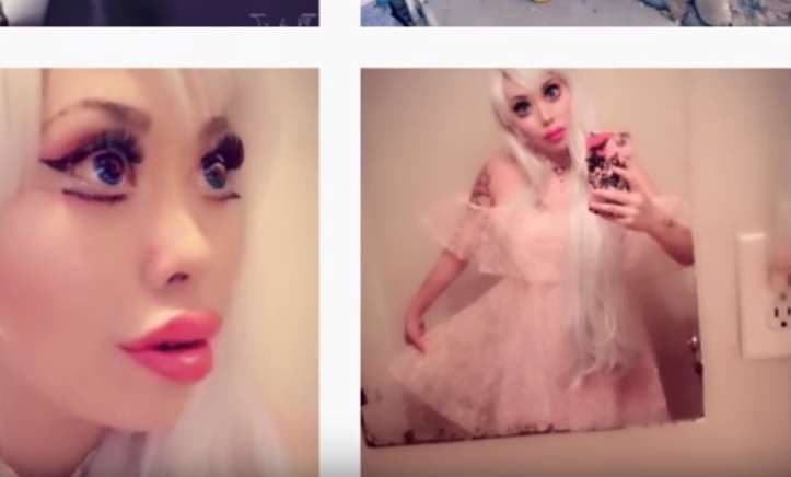 Operoi edhe sytë për t’u dukur si Barbie (VIDEO)