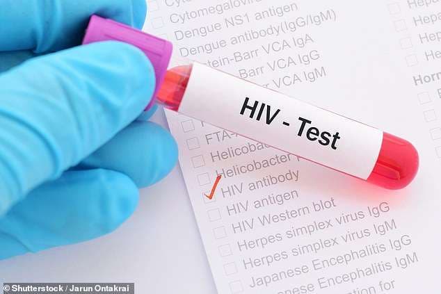 Shkencëtarët në prag të gjetjes së kurës për HIV