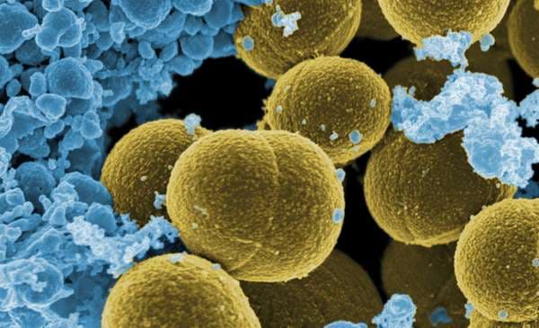 Bakteri që po bëhet rezistent ndaj antibiotikëve