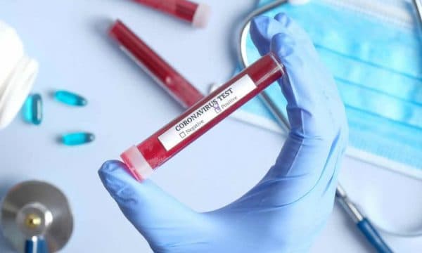 Bie numri i rasteve me koronarvirus në Gjilan