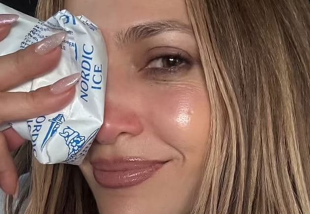 Jennifer Lopez pëson dëmtim të rëndë në fytyrë pas aksidentit në skenë