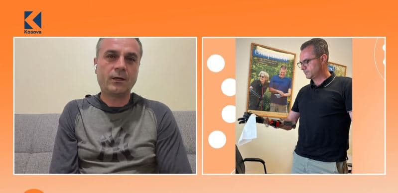 “Ia fala dorën atdheut”, ish-ushtari i UÇK-së rikthen buzëqeshjen me protezë elektronike (VIDEO)